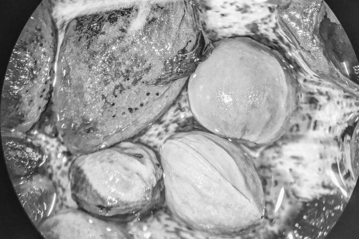 mineralised material including cherry (P. avium/cerasus) and plum (Prunus domestica)