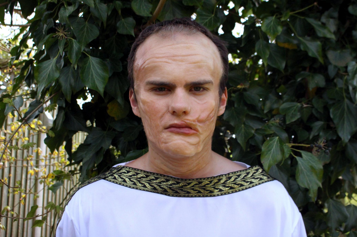 A man dressed as a Roman with prosthetic makeup used to reconstruct a partially healed injury