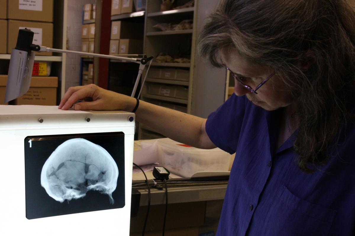Conservationist examining an x-ray of a skull