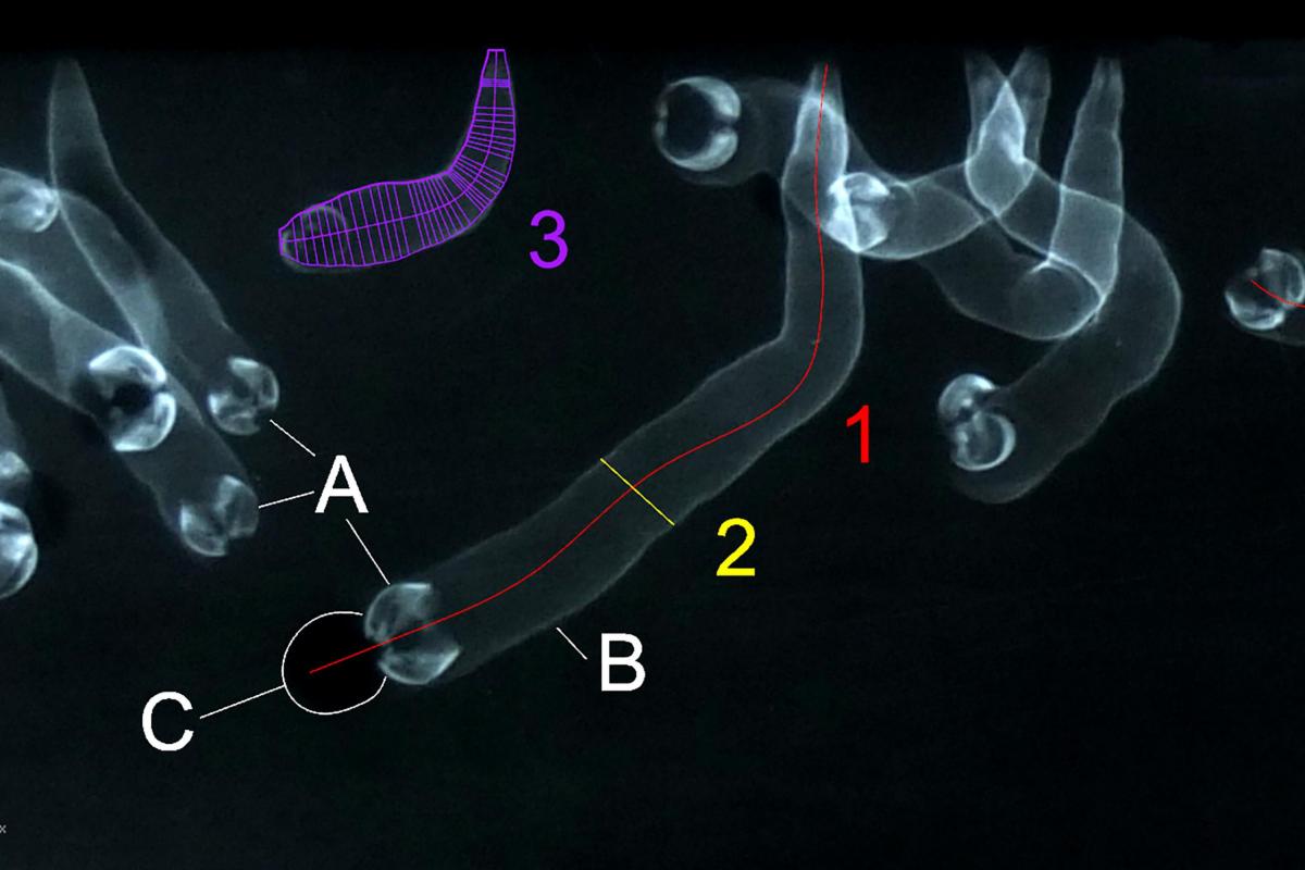 Measurement of X-ray in CAD
