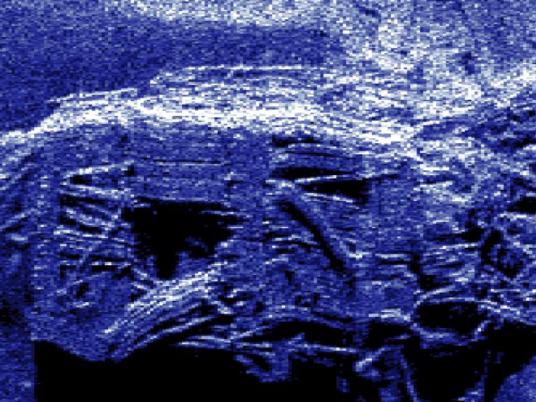 Geophysical survey of the South Australian wreck